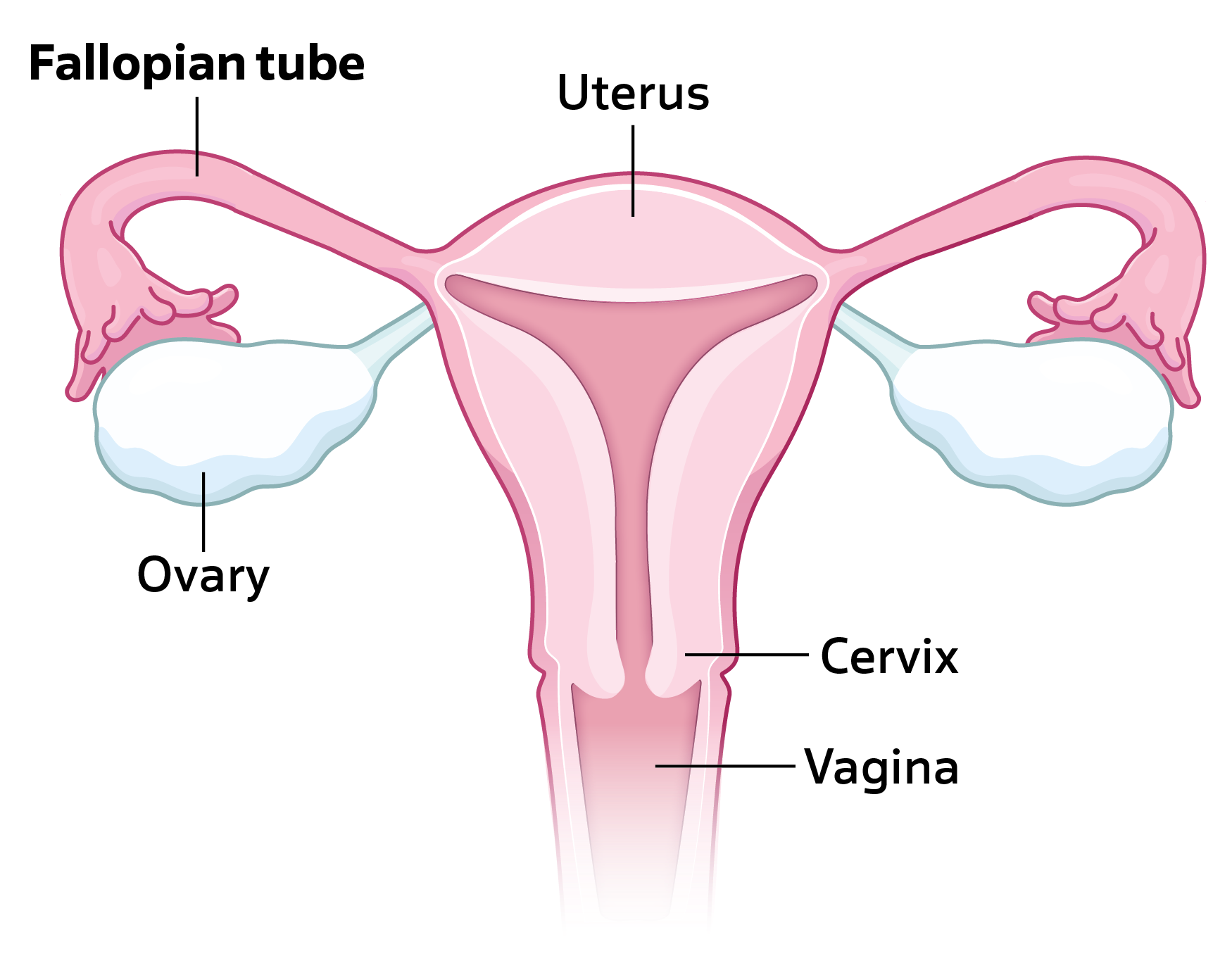 Fallopian tube diagram pointing out the fallopian tube, ovary, uterus, cervix, and vagina