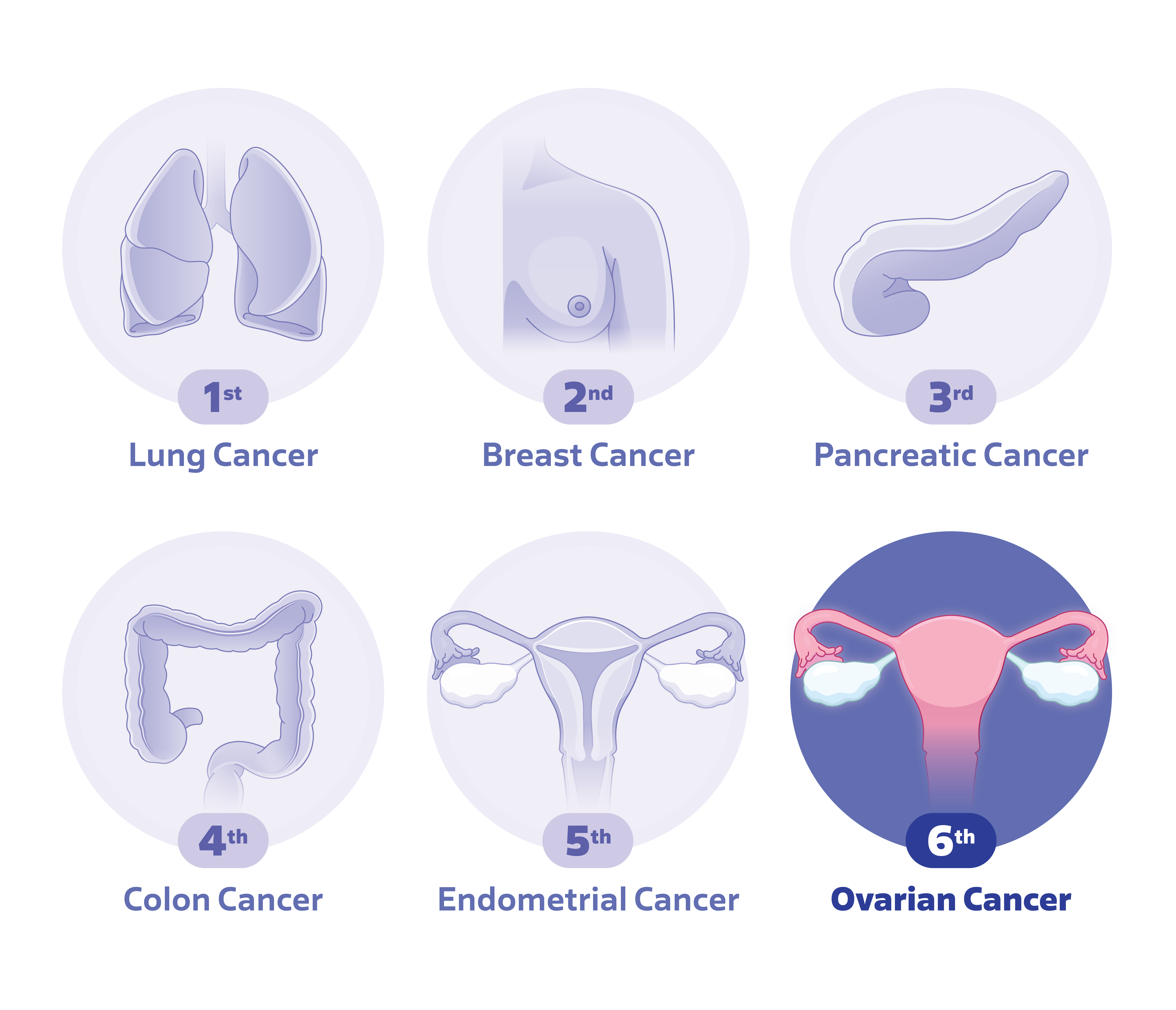 ranking of causes of cancer-related deaths